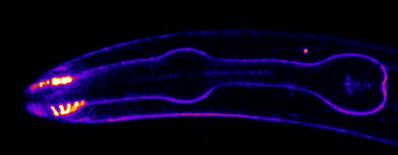Duke University researchers used gene-editing techniques to tag and light up proteins in the basement membranes of living worms and watch them in action using time-lapse microscopy. By Dan Keeley, UNC Chapel Hill
