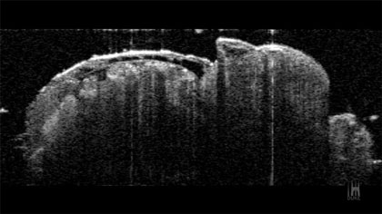 Image of fruit fly