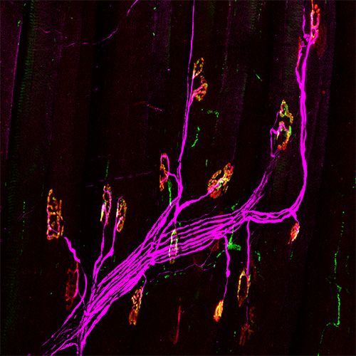 DUNE scholar Karina created this microscope image of muscle tissue from the diaphragm of mice with genetic brain disorder Pompe disease. Motor neurons required to stimulate the diaphragm (red) connect with neuromuscular cells (green). (ElMallah Lab)