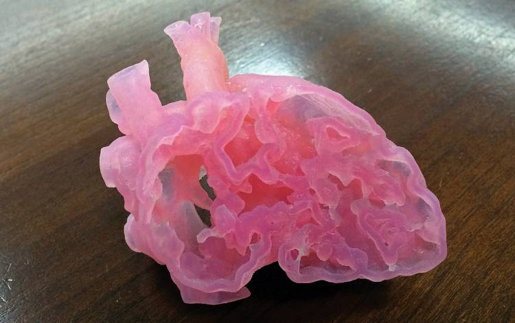 Duke Health purchased a 3-D printer that produces replicas of organs such as this pediatric patient’s heart.