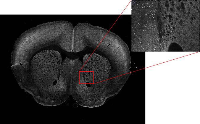 A mouse brain expresses a fluorescent protein in response to repeated stimuli, and bright regions show cells in areas that were especially active. The image shows just a single plane out of a whole volume data set of images.