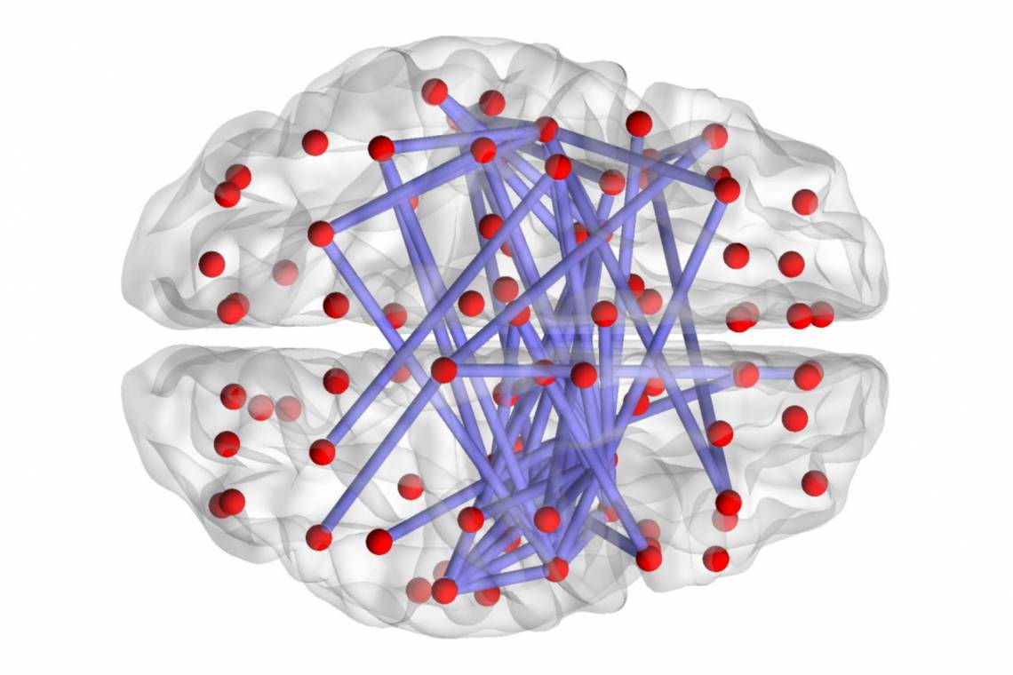 An image showing an overhead view of the brain with red lines indicating connections within the brain