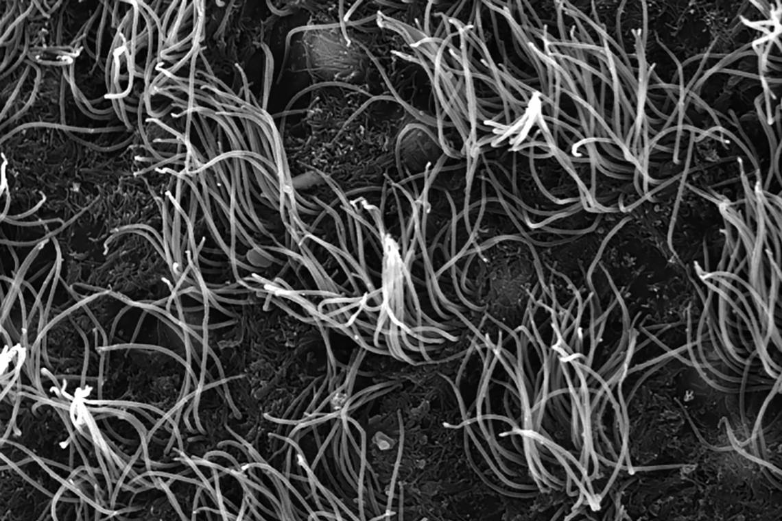 A black and white microscope image of ependymal cells in the brain
