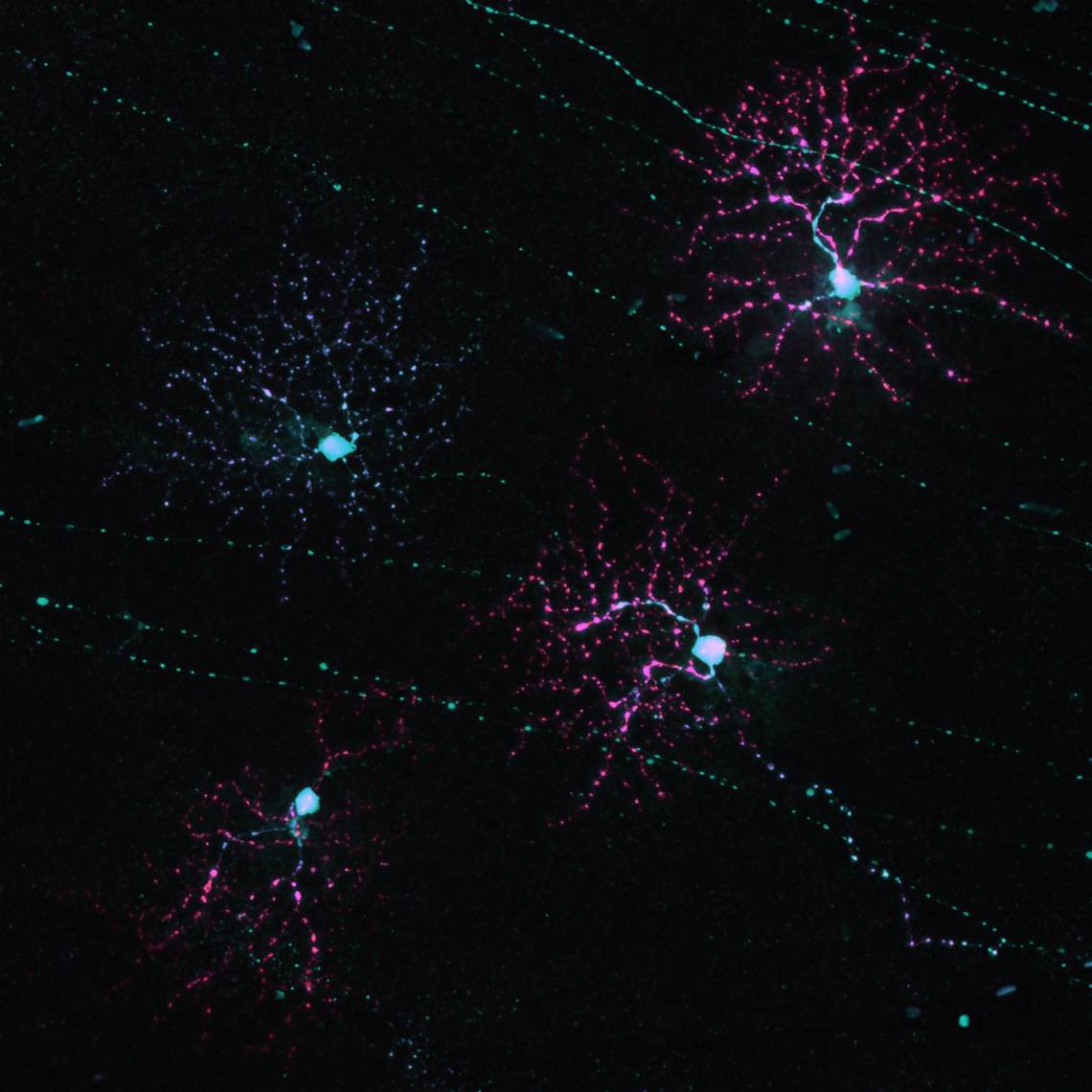 This image from a confocal microscope shows four retinal ganglion cells, the cells that send a signal from the retina to the brain. (Marija Rudzite, Duke University)