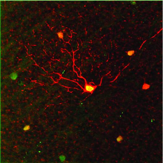 The ganglion cell layer of the retina is labelled with red to show the presence of a cell sensitive to motion in the upward direction. In low light, these cells pick up the faintest signals of any kind of motion. (Image: Duke, Univ. of Victoria)