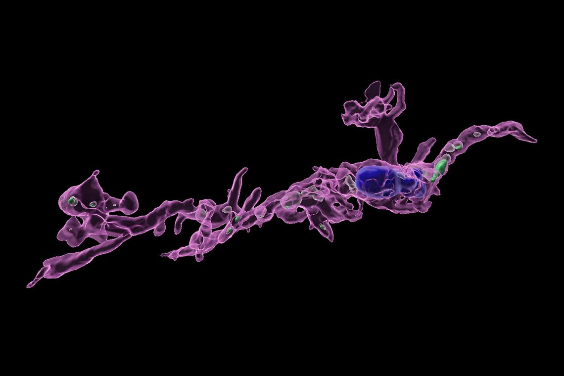 A microglia (in magenta) from a male mouse born to a mom on a high-fat diet, which sequesters more brain serotonin (in green) than males with mom’s eating a typical lab diet. (Bilbo Lab)