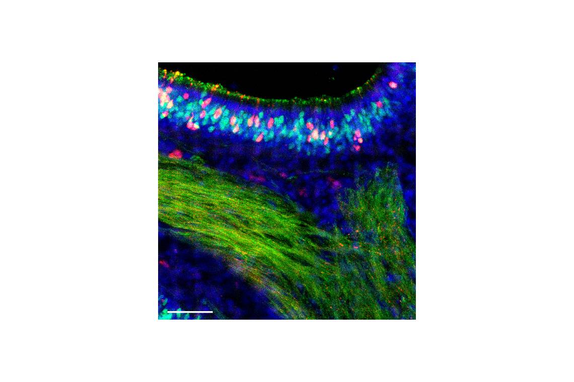 Fourteen days after infection with an influenza B virus, cells of a mouse nose are colored to show any remaining infection. Red cells were infected but have now cleared the virus. (Sebastian Wellford)