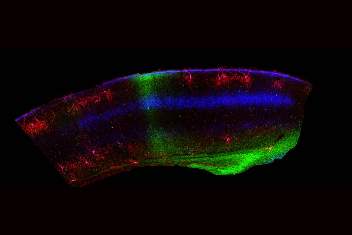 A portion of mouse visual cortex shows the binocular region in green. Chandelier cells are red in this image. Chandelier cells are clearly less plentiful in the binocular zone. (Bor-Shuen Wang, Cold Springs Harbor Lab)