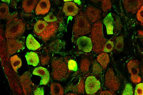Autism-linked protein SHANK3 (red) and pain receptor TRPV1 (green) interact with one another in sensory neurons outside of the brain. Photo credit - Qingjian Han, Duke University School of Medicine
