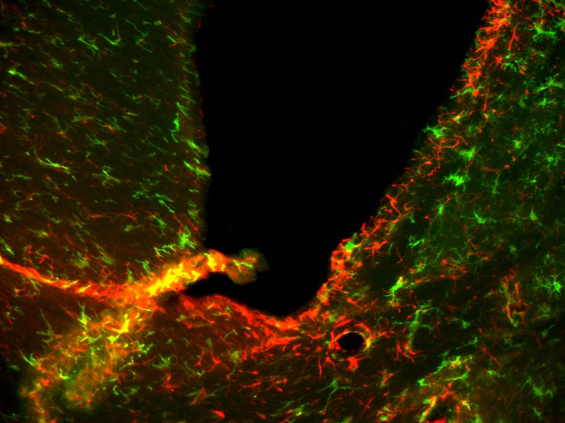 A microscope view of neurons (green) and immune cells (red) inside the brain of a mouse with a drug-resistant form of a disease closely related to MS. Courtesy of Mari Shinohara.