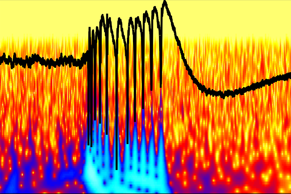 This colorful graph shows a peak of abnormal epileptic brain activity in a brain's hippocampus in which an inhibitory protein called InSyn1 has been depleted. Credit: Akiyoshi Uezu, Dan Kanak and Scott Soderling