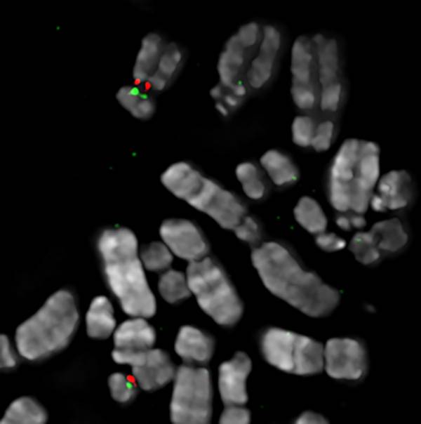 A set of human chromosomes with the “primary” and “backup” sites for centromere assembly on chromosome 17 painted in red and green, respectively. Credit: Beth Sullivan, Duke University