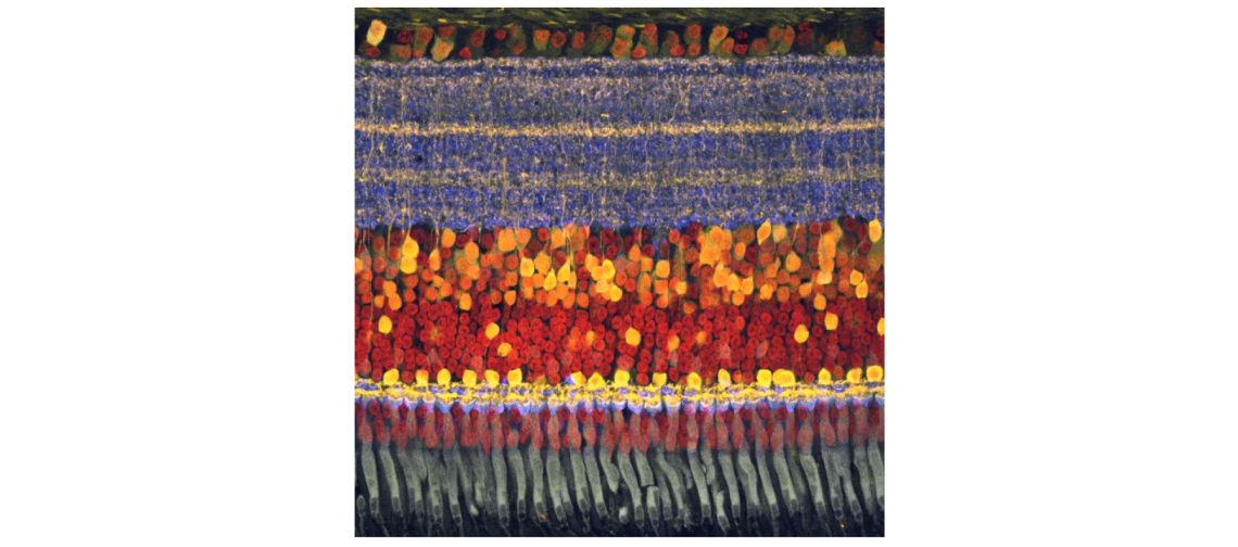 A photomicrograph of a chick retina shows the ganglion cell bodies in an orderly layer at the top and then the tangled layer of root-like dendrites in the blue and yellow layer below, which is where mosaics of different visual sensitivities are laid out. 