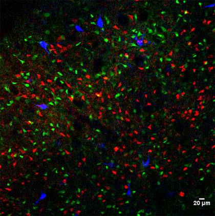 A genetically altered mouse that excessively washes its face shows an imbalance in brain activity involved in compulsive behavior. Cells responsible for driving particular behaviors are more active in these mice. A Duke study found that blocking a brain