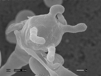 Spores on the surface of a fruiting structure from the fungus Cryptococcus deuterogattii, a deadly strain that emerged in the Pacific Northwest. (Credit: Edmond Byrnes III, Joseph Heitman -- Duke Department of Molecular Genetics and Microbiology; Valerie