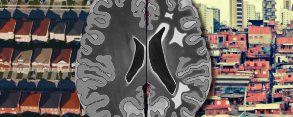 stylized brain scan, half typical adult, half reduced size for adult, overlaid suburb neighborhood aerial photo next to dense impecunious cityscape