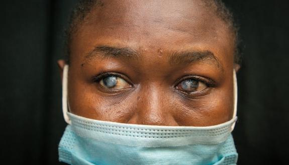 blind woman in West Africa. Photo by Chris Hildreth