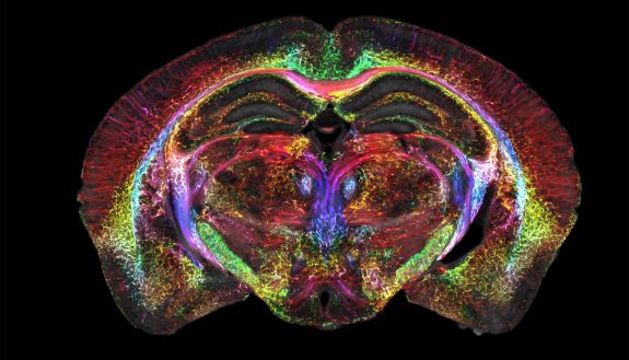 Multicolor image of a mouse brain in coronal cross-section
