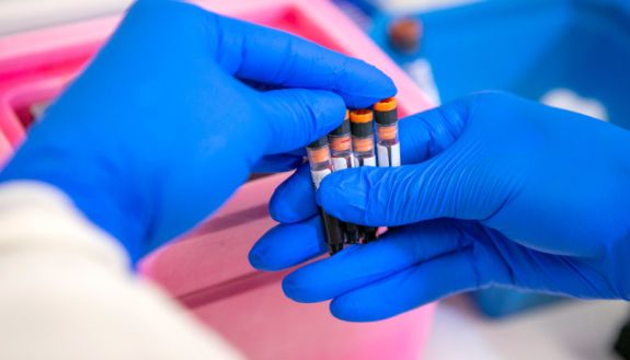 lab vials being handled by lab worker