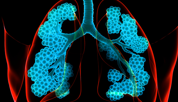 image of lungs with the aeoli marked in blue