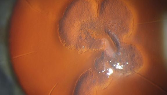 picture of an eye