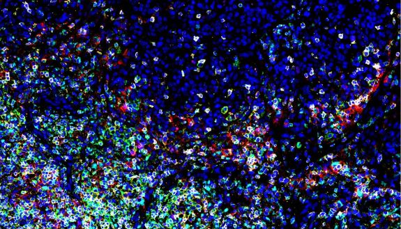 An imaging technique called multiplex imaging showing lots of different colors