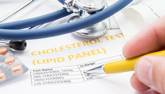 stock photo of cholesterol panel