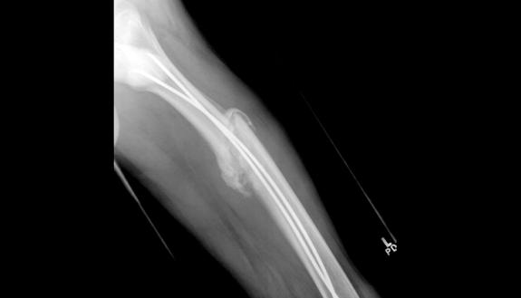 image of interior of broken bone