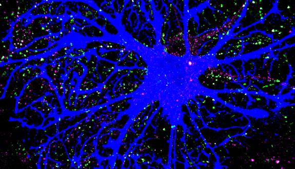 A microscope image of an bright blue, star-shaped cell in a dish