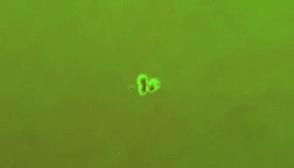 A bacterial colony genetically edited to include a gene circuit forms a purple ring as it grows. Researchers are using machine learning to discover interactions between dozens of variables that affect the ring’s properties such as its thickness, how fast 