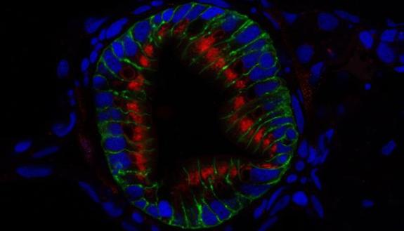 image of lysosome-rich enterocyte
