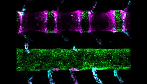 A single-letter DNA change in a gene that lays down the pattern for a developing spine in zebrafish caused mutant fish to develop backbones that resemble ancestral fish (bottom image). (Bagnat Lab – Duke) 