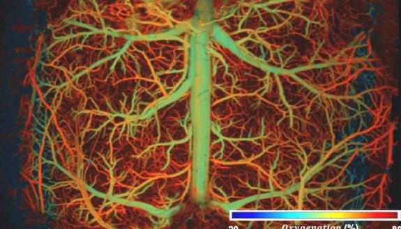 The image shows the vasculature of the brain, and the colors illuminate how capillaries experience varying levels of oxygenation as the brain undergoes hypoxia.