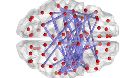 An image showing an overhead view of the brain with red lines indicating connections within the brain