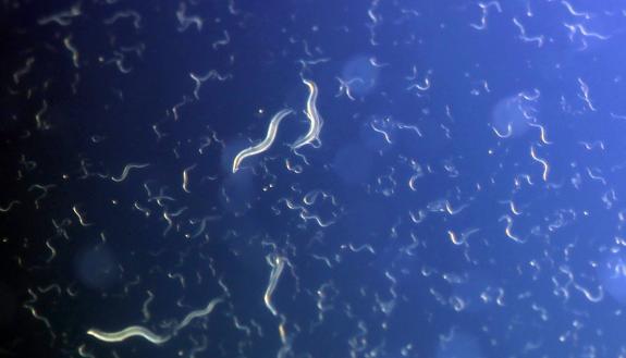 C. elegans worms whose mothers didn’t get enough to eat during pregnancy cope better with famine. Photo by Richard Pell, Carnegie Mellon.