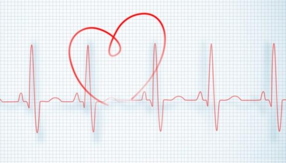 EKG chart