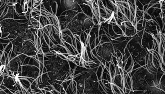 A black and white microscope image of ependymal cells in the brain