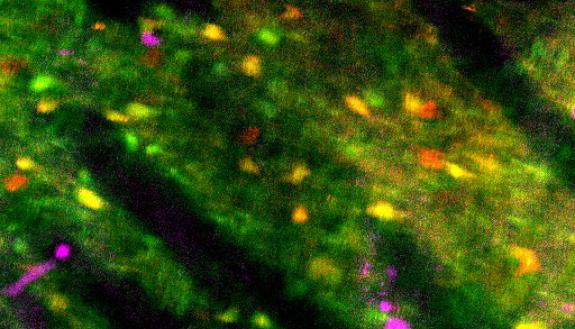  An image showing red and green spots with a scattering of purple spots