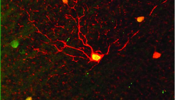 The ganglion cell layer of the retina is labelled with red to show the presence of a cell sensitive to motion in the upward direction. In low light, these cells pick up the faintest signals of any kind of motion. (Image: Duke, Univ. of Victoria)