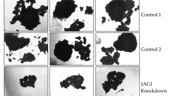 Cancer Cells