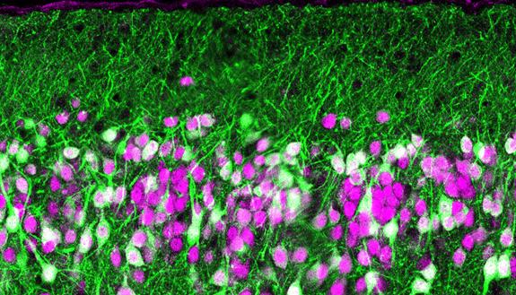 A section of a mouse’s olfactory cortex, where scent signals from the olfactory bulb are processed to help the brain identify odors. Disrupting this processing with a toxin (green) reveals how this processing works. (Kevin Franks lab)