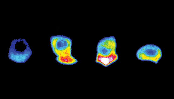 Behind the front lines of invasion: This time-lapse of a tiny worm cell hundreds of times smaller than a grain of sand shows the levels of ATP energy inside the cell before, during and after it trespasses into other tissues. Image by Aastha Garde.