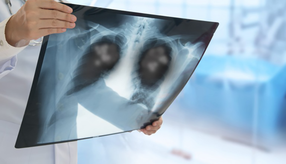 looking at an x-ray of a patient