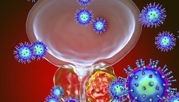 animation representation of cancer cells in the prostate