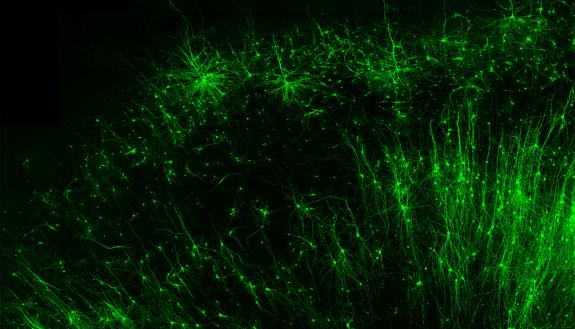 Tagging and illuminating only the inhibitory “brake” cells (green) in human brain tissue is just one of many things the new tool, CellREADR, can do. Credit – Derek Southwell, Duke University