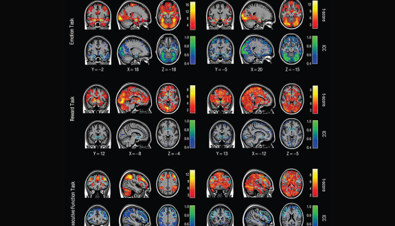 Brain scans showing functional MRI mapping for three tasks across two different days. Warm colors show the high consistency of activation levels across a group of people. Cool colors represent how poorly unique patterns of activity can be reliably measure