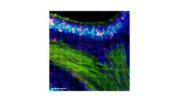 Fourteen days after infection with an influenza B virus, cells of a mouse nose are colored to show any remaining infection. Red cells were infected but have now cleared the virus. (Sebastian Wellford)