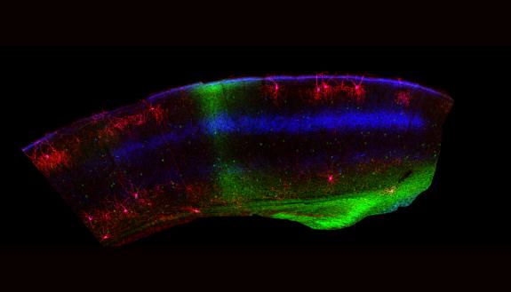 A portion of mouse visual cortex shows the binocular region in green. Chandelier cells are red in this image. Chandelier cells are clearly less plentiful in the binocular zone. (Bor-Shuen Wang, Cold Springs Harbor Lab)