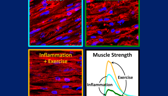 Long, thin, well-defined muscle fibers (top left) are in shambles after prolonged inflammation (top right), but maintain their structure (bottom left) and strength (bottom right) when exercised during the inflammation.
