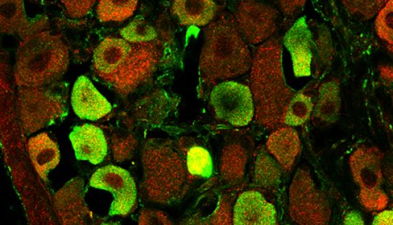 Autism-linked protein SHANK3 (red) and pain receptor TRPV1 (green) interact with one another in sensory neurons outside of the brain.  Photo credit - Qingjian Han, Duke University School of Medicine